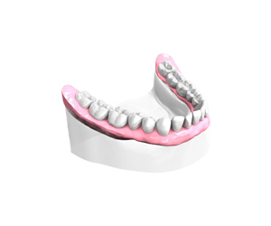 Remplacer toutes les dents absentes ou abîmées à Maisons-Alfort